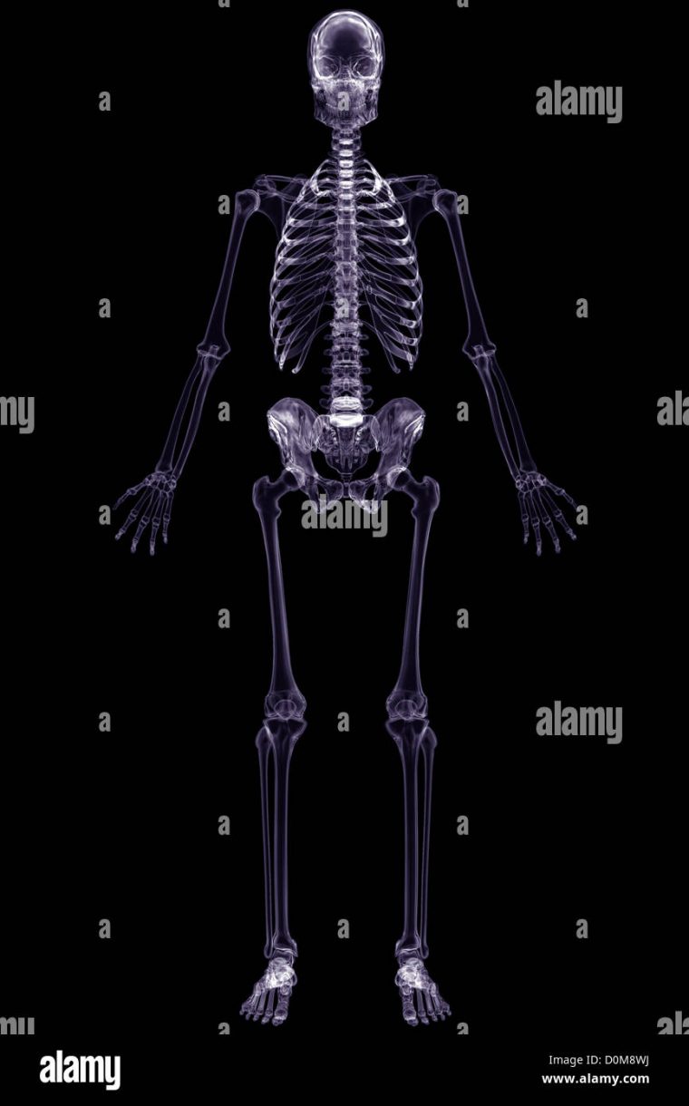 free body x ray